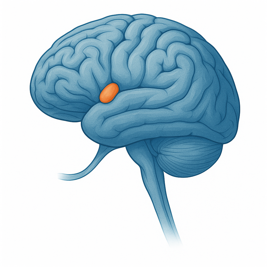 Anterior clinoid meningioma near the optic nerve—skull base brain tumor illustration